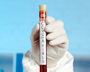 В Гродно откроют вторую в области лабораторию по тестированию на коронавирус. На Гродненщине - новые очаги В Гродно откроют вторую в области лабораторию по тестированию на коронавирус. На Гродненщине - новые очаги