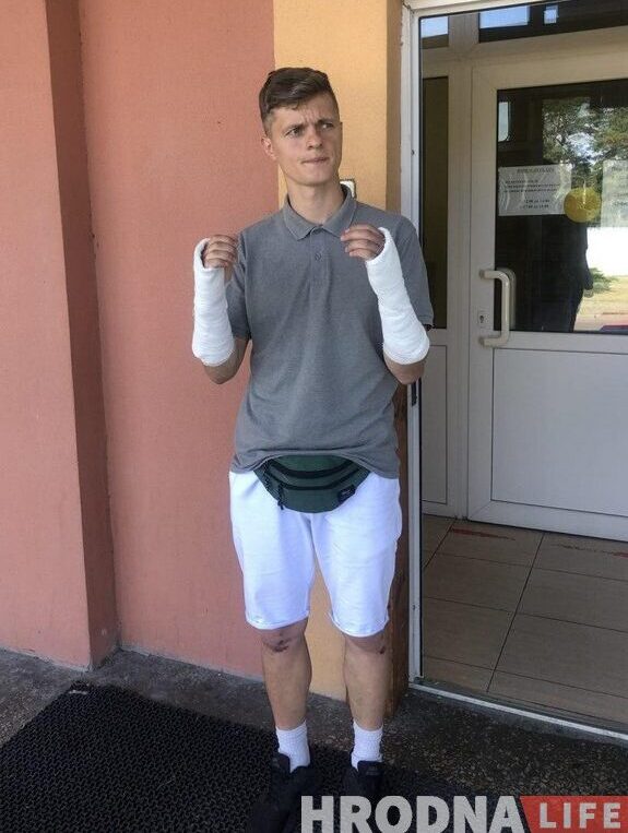 У журналиста Hrodna.Life Руслана Кулевича - переломы обеих рук