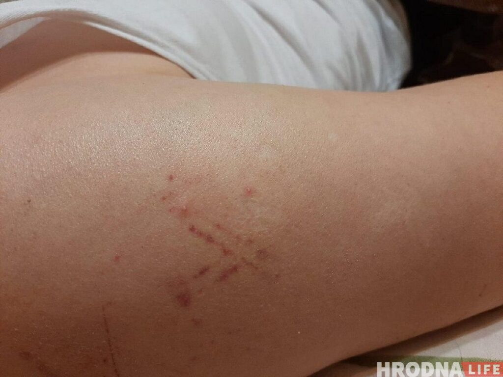 УВД, СИЗО и врачи Гродно засекретили количество задержанных и избитых ОМОНом в городе