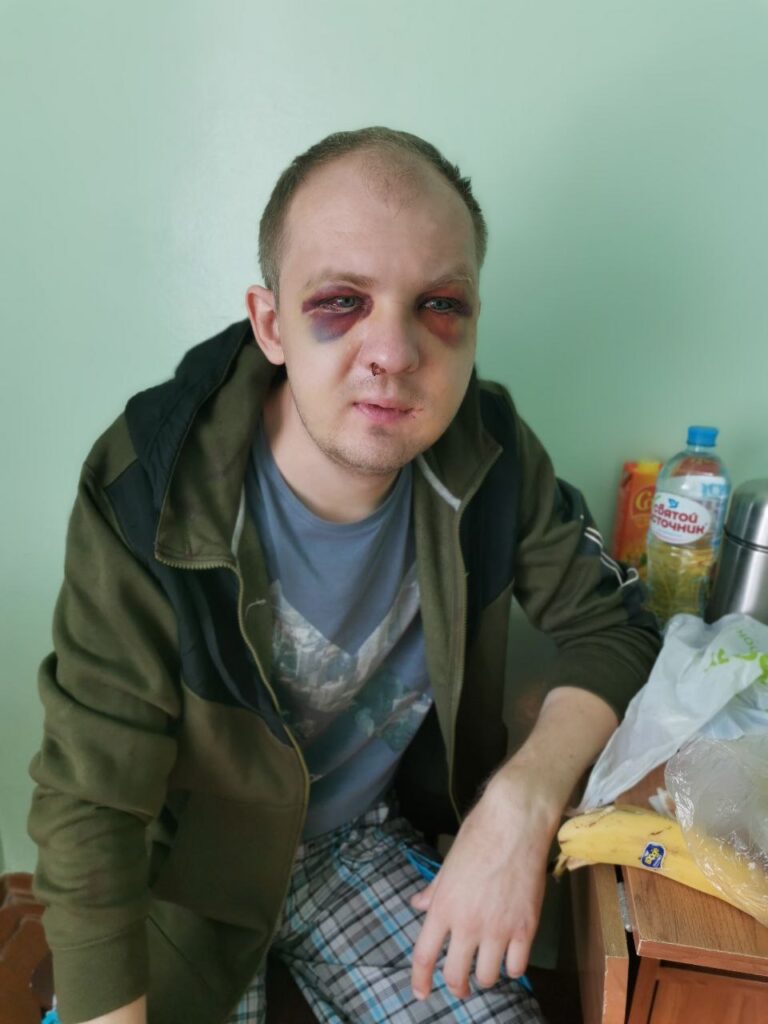 У Гродне пачалі судзіць таксіста, якога збіў АМАП. Пацярпелых двое, у аднаго - некалькі сінякоў