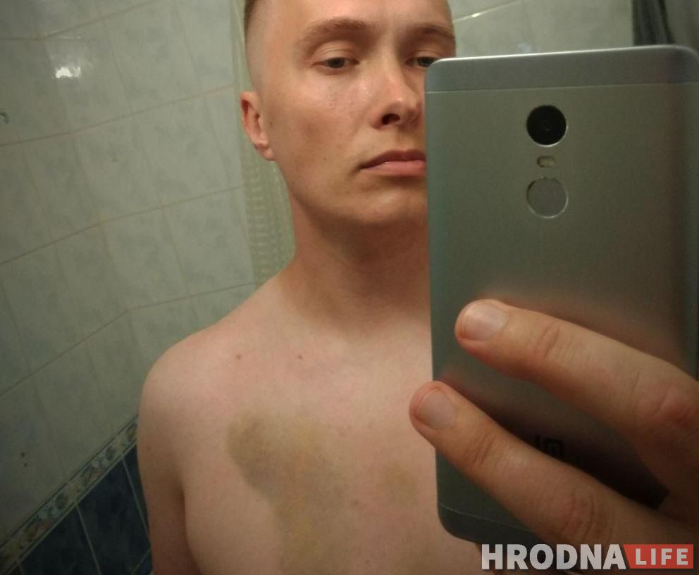 «Фашисты в кино — вежливые люди по сравнению с ними». Бармен из Гродно, — о 14 часах после встречи с ОМОНом