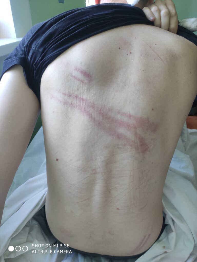 Во время протестов ОМОНовец напал на таксиста в Гродно и пострадал. Избитого гродненца могут посадить