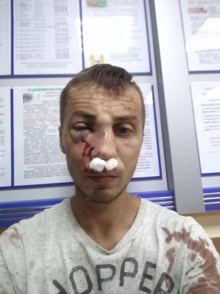 «Мы любого убьем, но вам город не отдадим». О чем рассказали гродненцы, пришедшие снимать побои в судмедэкспертизу