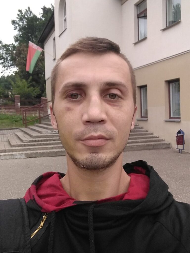 «Мы любого убьем, но вам город не отдадим». О чем рассказали гродненцы, пришедшие снимать побои в судмедэкспертизу