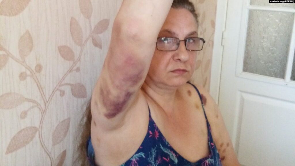 В Гродно начался суд над покусавшей сотрудниц ОМОНа 55-летней Мариной Поликарповой