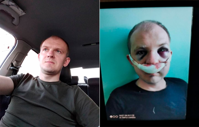 «На их месте мог оказаться и я». Свидетель по делу избитого таксиста уехал за границу и хотел выступить в суде по видеосвязи