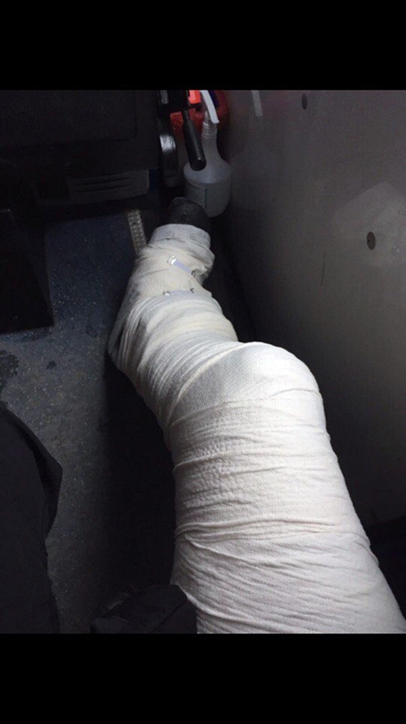 Калі страхоўка мае значэнне. Гродзенец пацярпеў на адпачынку ў Закапанэ, медыкі выставілі яму рахунак на 250 долараў Калі страхоўка мае значэнне. Гродзенец пацярпеў на адпачынку ў Закапанэ, медыкі выставілі яму рахунак на 250 долараў