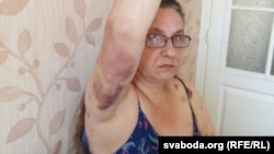 «Заткн еб🤬ло, с🤬ка». 55-летняя гродненка при задержании укусила омоновку. Её избили, а сейчас завели уголовное дело