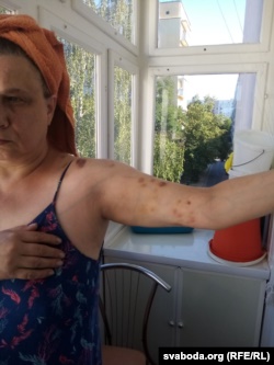 «Заткн еб🤬ло, с🤬ка». 55-летняя гродненка при задержании укусила омоновку. Её избили, а сейчас завели уголовное дело