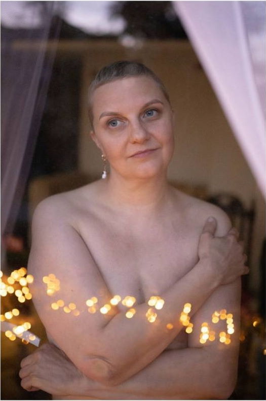 Пра рак. Гісторыі беларусак