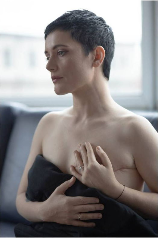 Пра рак. Гісторыі беларусак