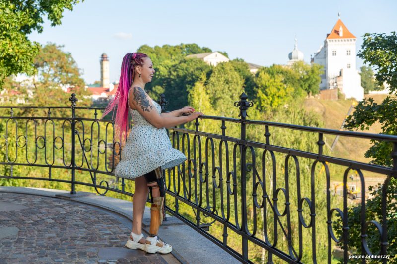 Гродненка с протезом, победившая в конкурсе красоты: “Модели с инвалидностью - это обычно, но наше общество еще не готово”