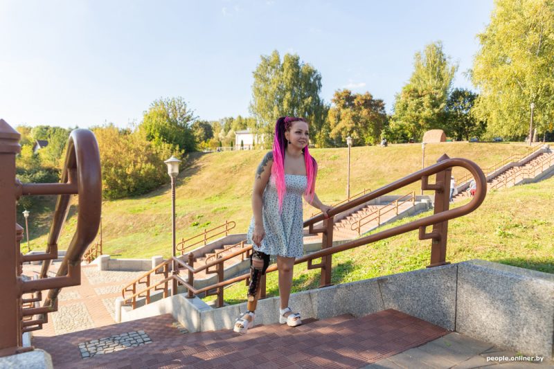 Гродненка с протезом, победившая в конкурсе красоты: “Модели с инвалидностью - это обычно, но наше общество еще не готово”